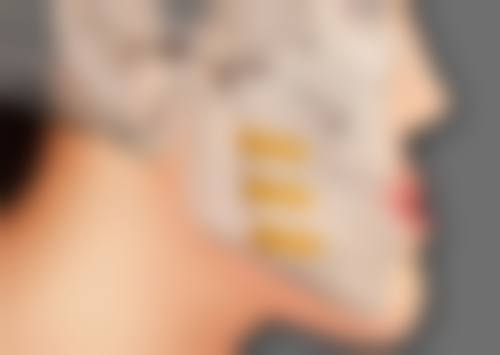 刘静雅医生做手术价格