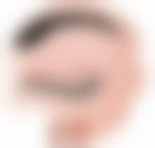 线提升隆鼻子能保持一辈子吗？微创快速美鼻的短期之策