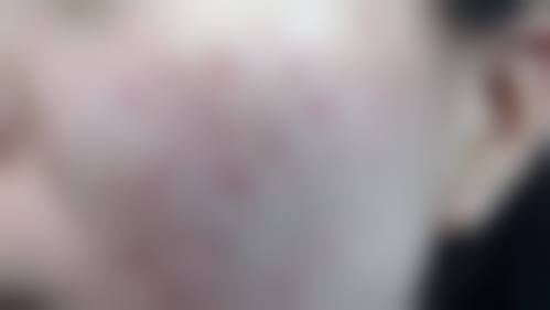 兰州韩美整形齿科怎么样？是否正规