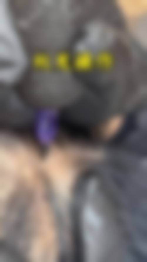 深圳汇来医疗美容诊所更擅长什么手术