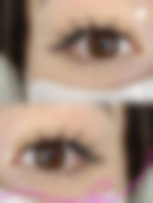 济南皓月源医疗美容诊所价格表