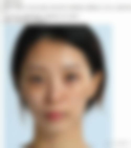 武汉斯启诺医疗美容门诊部王伟民4800元眼袋整形项目揭秘