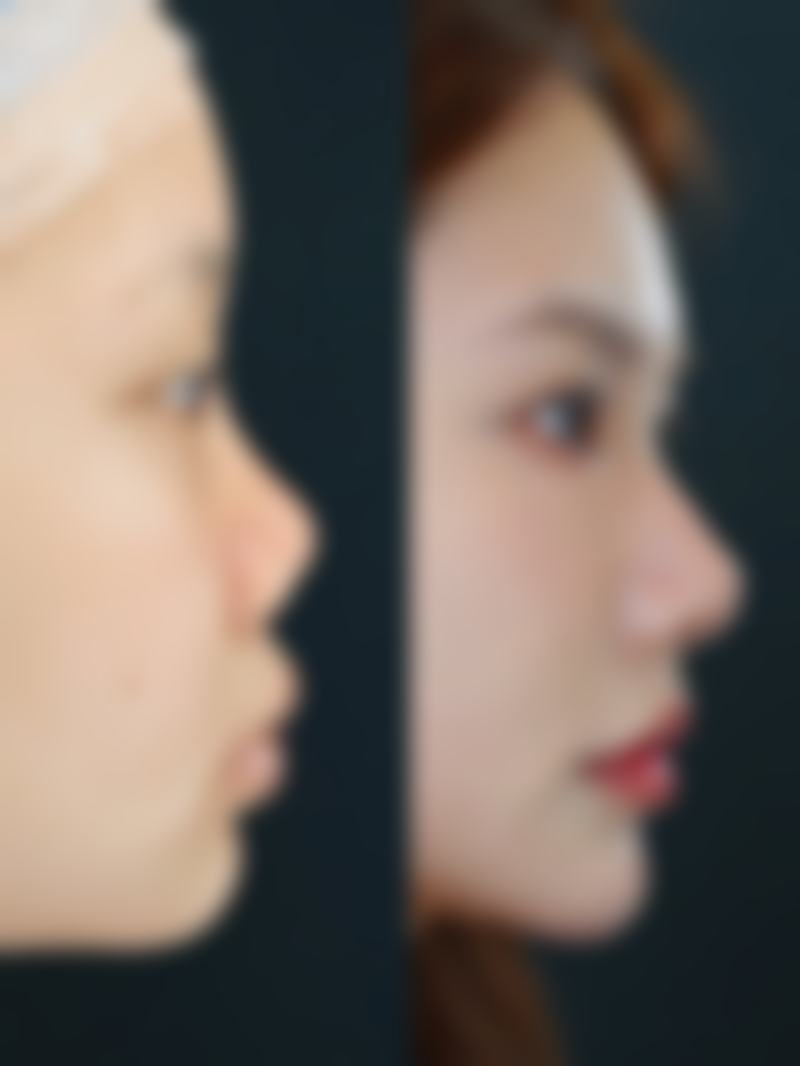 广州翊美整形医疗美容门诊部更擅长什么