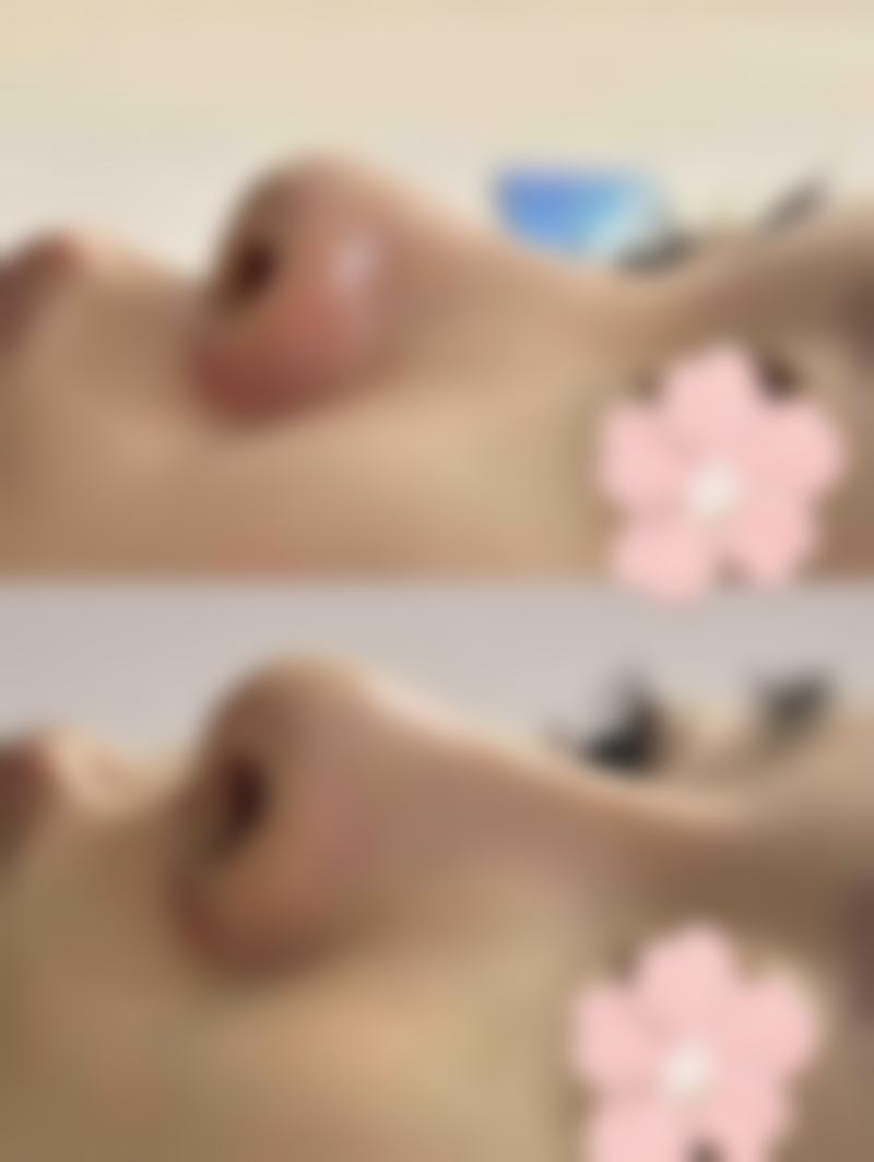 郑州徐医生医疗整形美容医院怎么样，口碑评价如何？