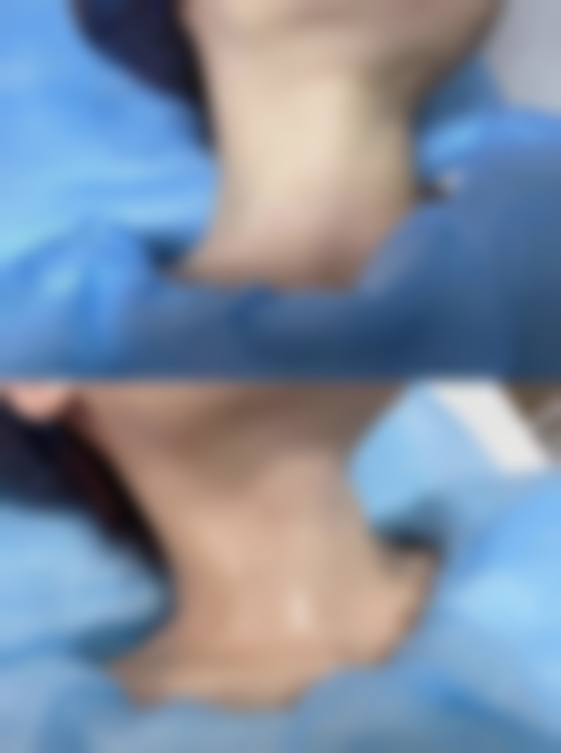 李允焕医生简介口碑如何