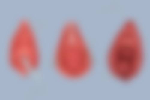 哪些新鲜芦荟适合直接涂在疤痕上