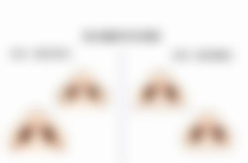 万一出现溶脂瘦脸针副作用，该如何处理