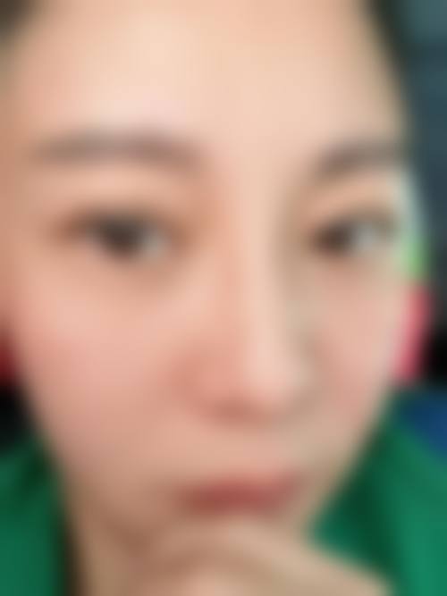 邗江区正规医美医院名单——扬州黄婵艾菲斯医疗美容诊所