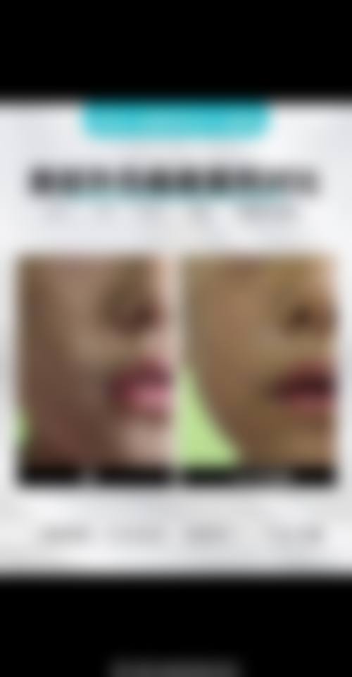 邗江区正规医美医院名单——扬州韩美医疗美容诊所