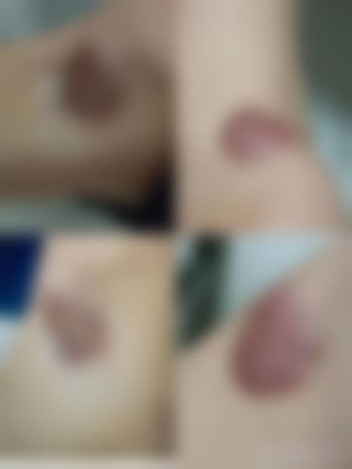 邗江区正规医美医院名单——扬州广陵艾菲斯医疗美容门诊部