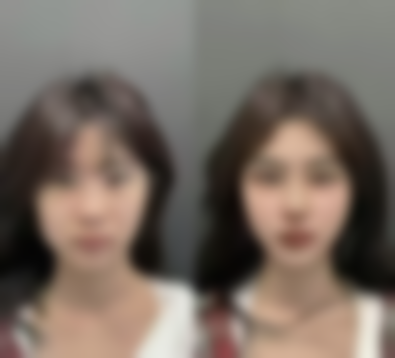 山东省立医院解析新鲜芦荟涂疤危害及预防