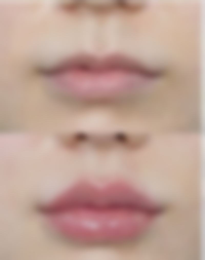 科学预防溶脂瘦脸针副作用的6个秘诀