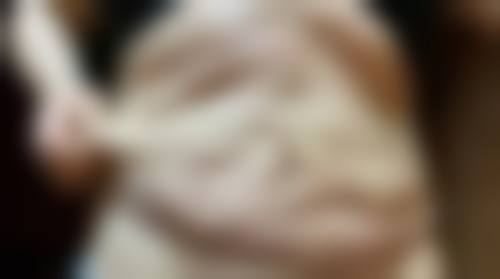 绿毒瘦脸针效果如何？维持时间+真实案例对比，效果持久度大揭秘！