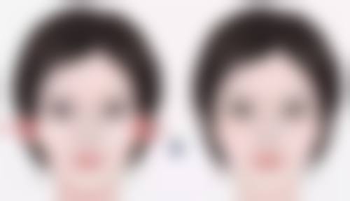 去除疤痕疙瘩的方法有哪些——放射治疗:精细的“射线狙击”