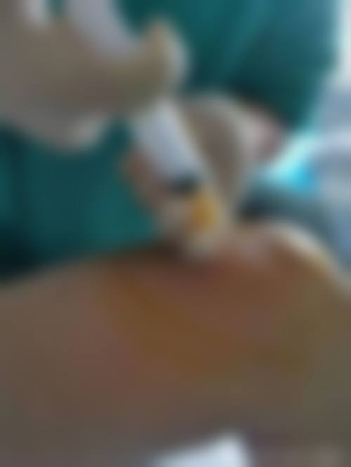 洛阳华美整形医院怎么样:真实患者口碑评价