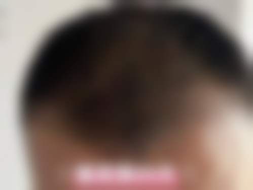 湖州长兴焕颜医疗美容门诊部顾客实例