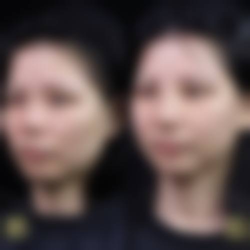 罗燕医生简介做手术价格