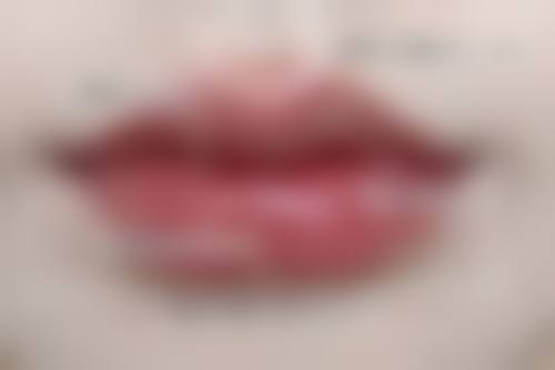 打瘦脸针脸肿要注意什么