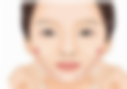 长春莱美姜医生医疗美容门诊部顾客实例