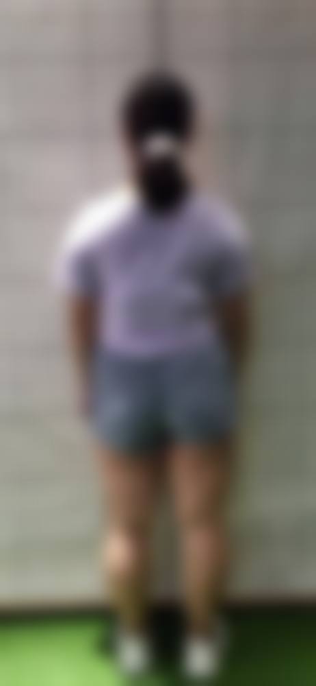 济南爱容整形美容医院口碑好不好？附真实患者口碑评价