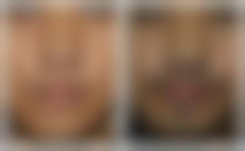 鞍山医美莱医疗美容诊所更擅长什么手术