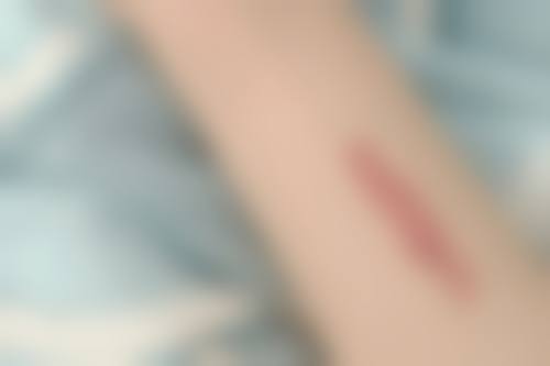 和歌山SkinCare诊所更擅长什么手术