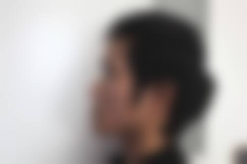 汕头汕美整形医院价格表