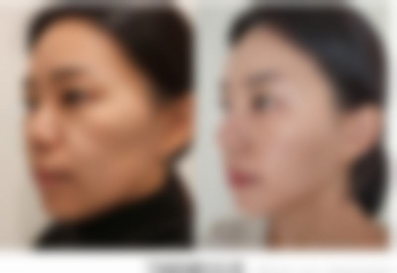 济南爱容整形美容医院项目特色