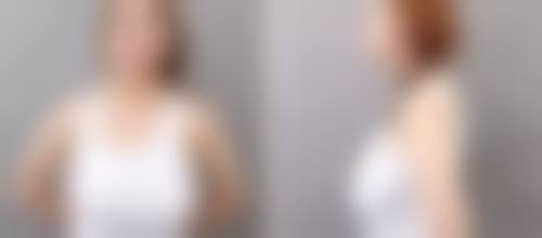 罗吉华医生做手术价格