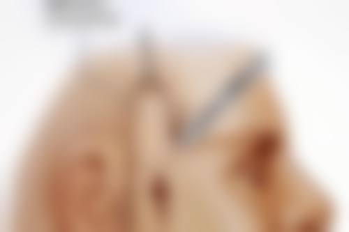 爱贝芙隆鼻恒久成效的维持时间探讨