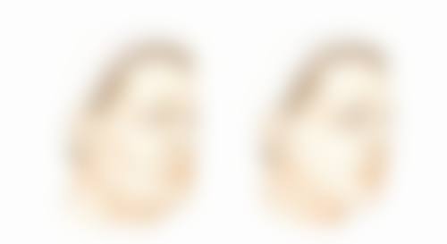 阴道紧缩手术对身体伤害的发生概率