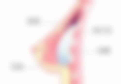 陈黎明医生简介做手术价格