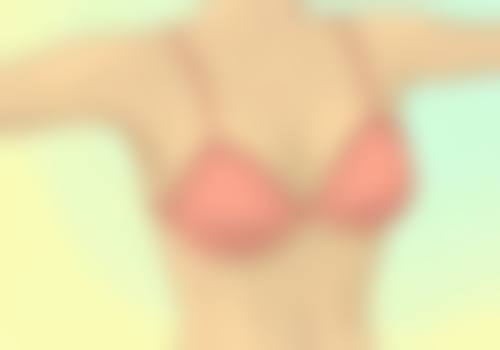 爱贝芙隆鼻恒久成效的成功实例展示