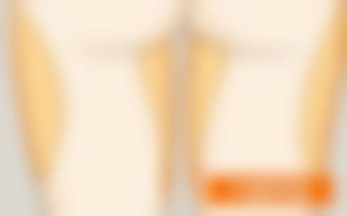 阴道紧缩手术对身体伤害程度的影响因素