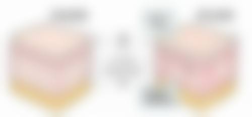 甲亢手术疤痕怎样修复的好之注意事项：避开这些“美丽陷阱”