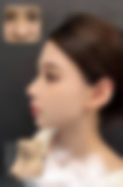 庄代江医生做手术价格