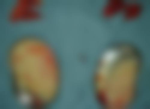 叶春伙医生简介口碑如何