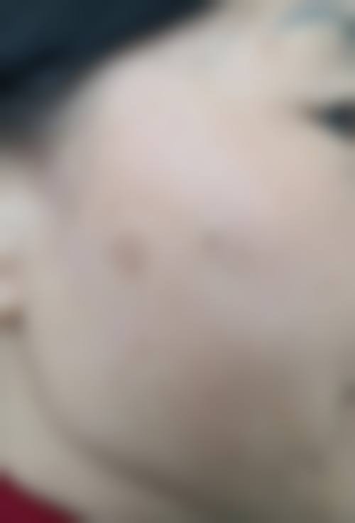 上海悦丽医疗美容门诊部怎么样