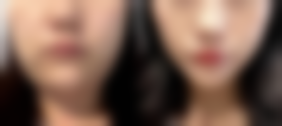 石家庄美莱医疗美容抖音团购活动及价格表