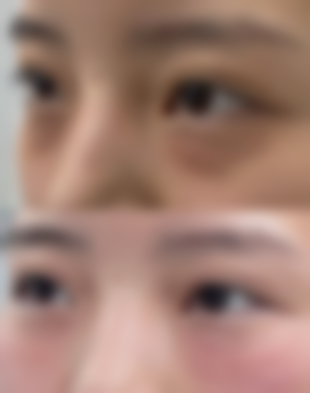 阴道紧缩手术对身体有伤害吗？3大风险+5个预防措施必看