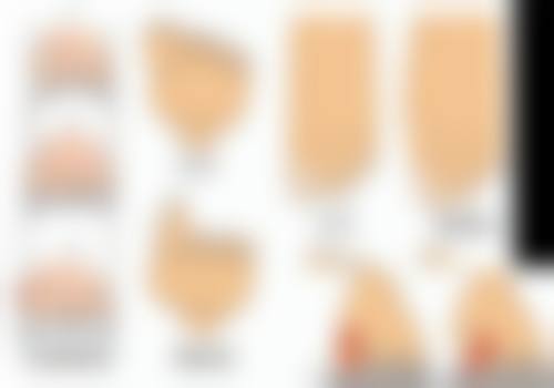 埋线双眼皮到底能维持多久