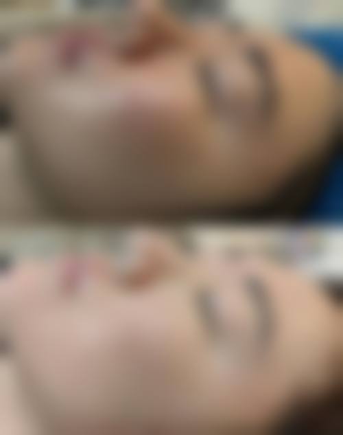 胡继来医生项目优势