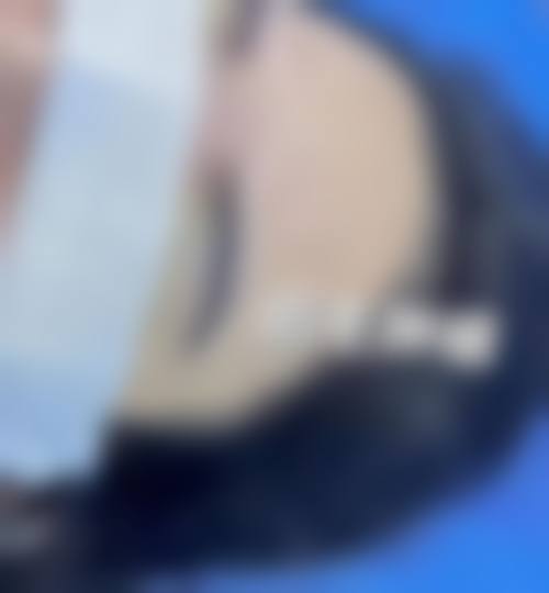 郭建滨医生简介项目优势