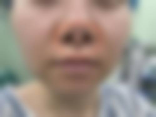 锦州斯美诺整形美容医院口碑评价