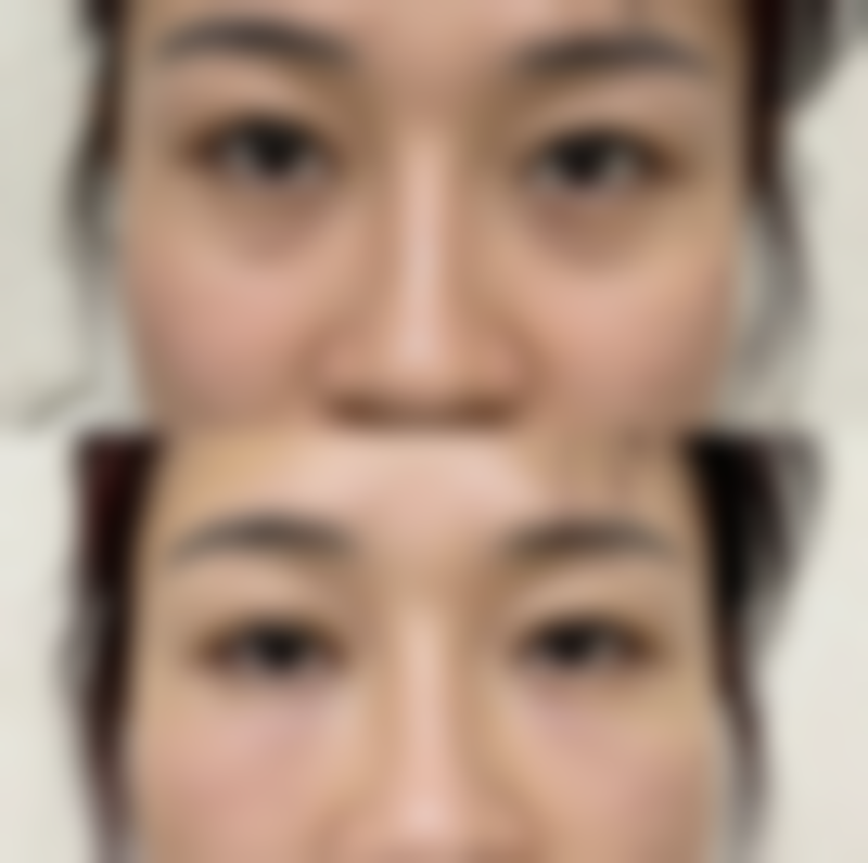 加藤大典医生项目优势