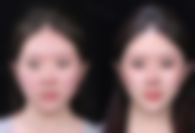 彬哲源医生简介做手术价格