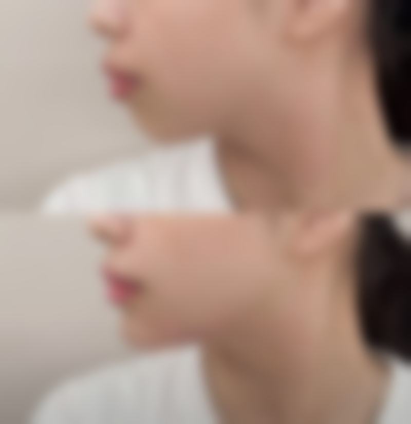 割双眼皮喝豆浆的影响之有益论证