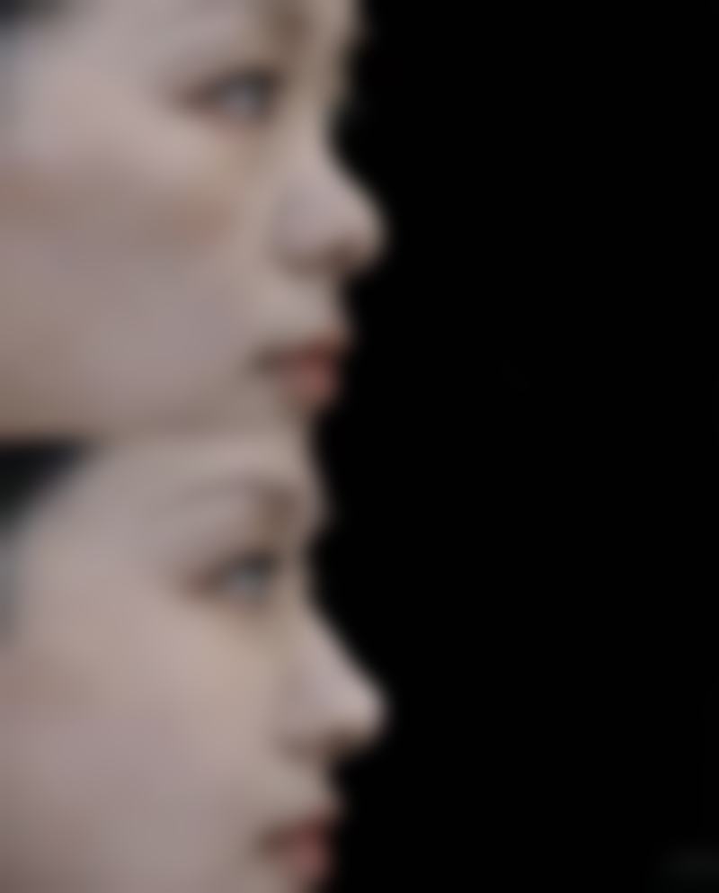 尾段：告别刀疤，重拾自信