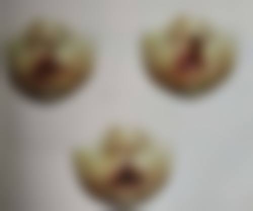 烫伤的疤痕怎么能去掉？专业医院激光治疗+中医偏方双管齐下，儿童护理要点全解析