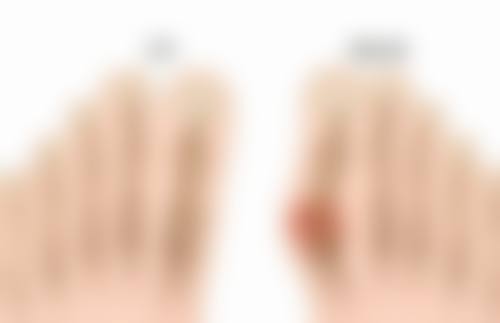 黑眼袋怎么产生的——年龄刻画的“岁月痕迹”